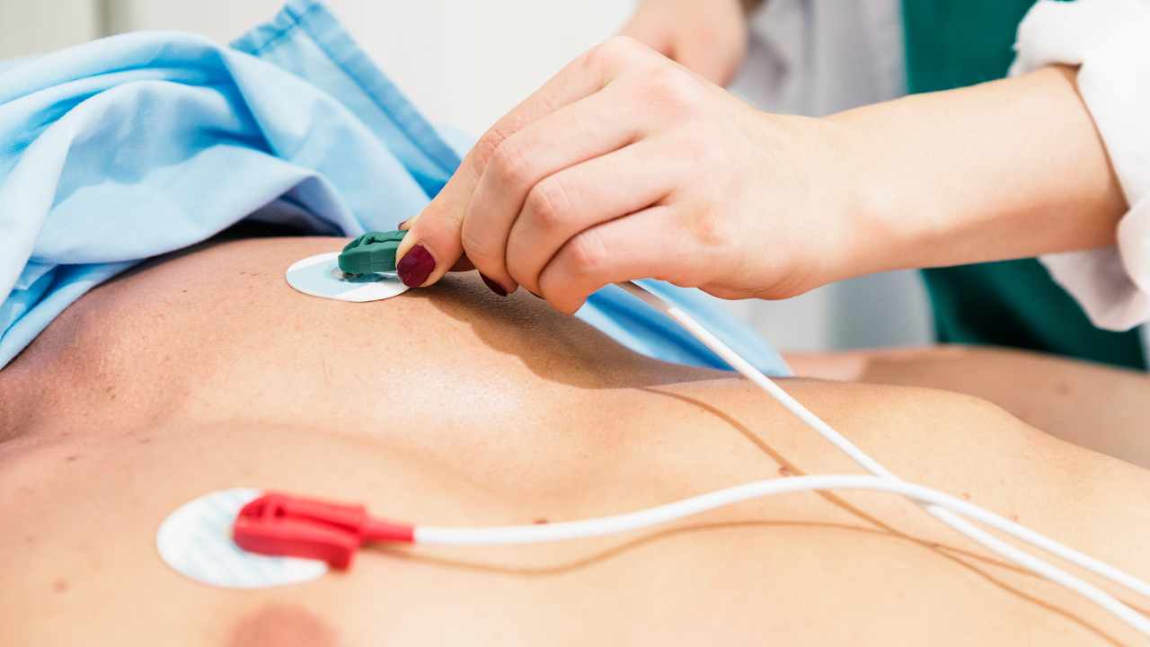 ECG Electrodes: Enhancing Cardiac Monitoring