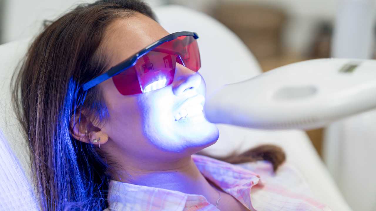 Unlock Your Best Smile: 10 Ways Teeth Whitening Can Transform Your Confidence